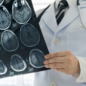 kwaliteit-van-zorg-verbeteren-nationaal-ms-fonds Het Nationaal MS Fonds financiert diverse projecten om de kwaliteit van de MS-zorg te verbeteren