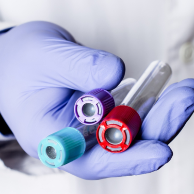 proefdiervrij-onderzoek-naar-ms-nationaal-ms-fonds-768×768 proefdiervrij-onderzoek-naar-ms-nationaal-ms-fonds-768x768